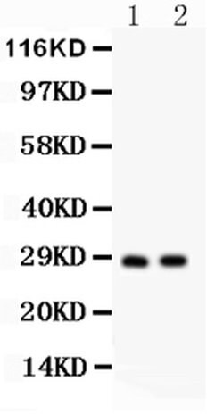 LAT Polyclonal Antibody, Invitrogen 100 &mu;g; Unconjugated:Antibodies,