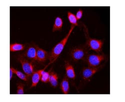 Invitrogen LCK Polyclonal Antibody 100 &mu;g; Unconjugated:Antibodies,