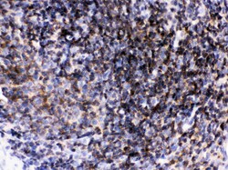 Invitrogen LCK Polyclonal Antibody 100 &mu;g; Unconjugated:Antibodies,