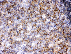 Invitrogen LCK Polyclonal Antibody 100 &mu;g; Unconjugated:Antibodies,