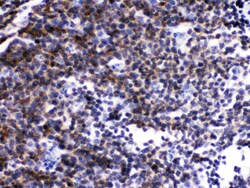 Invitrogen LCK Polyclonal Antibody 100 &mu;g; Unconjugated:Antibodies,