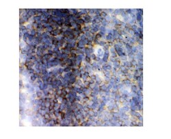Invitrogen LCK Polyclonal Antibody 100 &mu;g; Unconjugated:Antibodies,