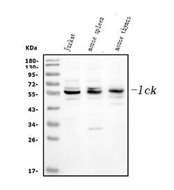 Invitrogen LCK Polyclonal Antibody 100 &mu;g; Unconjugated:Antibodies,
