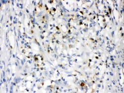 Invitrogen NGAL Polyclonal Antibody 100 &mu;g | Buy Online | Invitrogen&trade; | Fisher Scientific