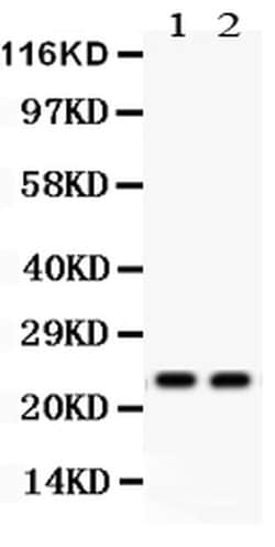 Invitrogen NGAL Polyclonal Antibody 100 &mu;g | Buy Online | Invitrogen&trade; | Fisher Scientific
