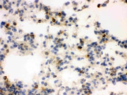 Invitrogen NGAL Polyclonal Antibody 100 &mu;g; Unconjugated:Antibodies,
