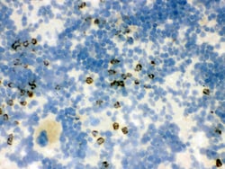 Invitrogen NGAL Polyclonal Antibody 100 &mu;g; Unconjugated:Antibodies,