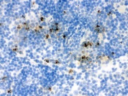Invitrogen NGAL Polyclonal Antibody 100 &mu;g; Unconjugated:Antibodies,