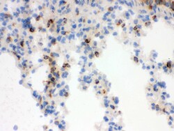 Invitrogen NGAL Polyclonal Antibody 100 &mu;g; Unconjugated:Antibodies,