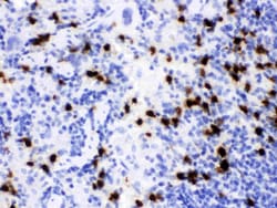 Invitrogen NGAL Polyclonal Antibody 100 &mu;g; Unconjugated:Antibodies,