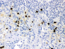 Invitrogen NGAL Polyclonal Antibody 100 &mu;g; Unconjugated:Antibodies,