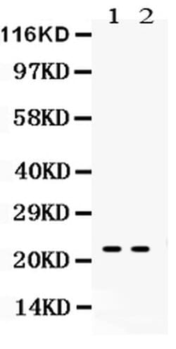 Invitrogen NGAL Polyclonal Antibody 100 &mu;g; Unconjugated:Antibodies,
