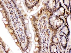 Invitrogen LDHA Polyclonal Antibody 100 &mu;g; Unconjugated:Antibodies,