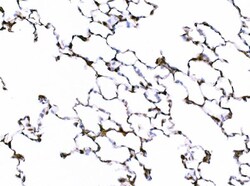 Invitrogen Galectin 3 Polyclonal Antibody 100 &mu;g; Unconjugated:Antibodies,