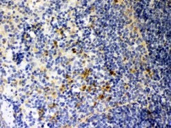 Invitrogen Galectin 3 Polyclonal Antibody 100 &mu;g; Unconjugated:Antibodies,