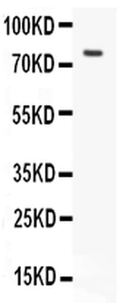 Invitrogen LHR Polyclonal Antibody 100 &mu;g | Buy Online | Invitrogen&trade; | Fisher Scientific