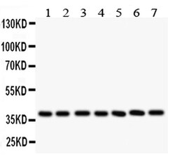 Invitrogen LIF Polyclonal Antibody 100 &mu;g; Unconjugated:Antibodies,