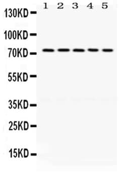 Invitrogen LIMK1 Polyclonal Antibody 100 &mu;g | Buy Online | Invitrogen&trade; | Fisher Scientific