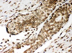 Invitrogen Lamin A/C Polyclonal Antibody 100 &mu;g; Unconjugated:Antibodies,