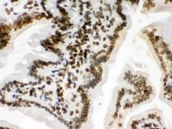 Invitrogen Lamin B1 Polyclonal Antibody 100 &mu;g; Unconjugated:Antibodies,