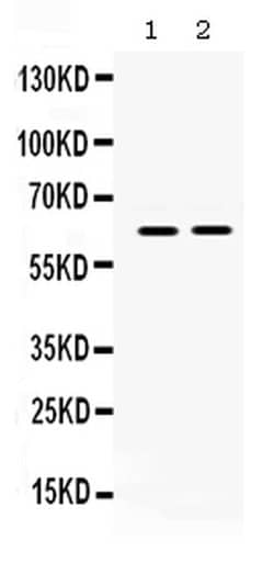 Invitrogen LOXL1 Polyclonal Antibody 100 &mu;g; Unconjugated:Antibodies,