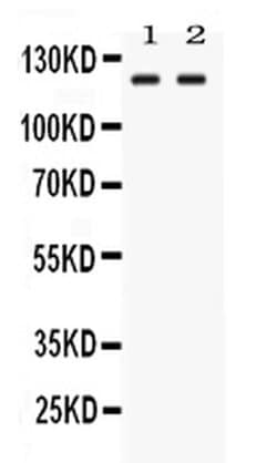 Invitrogen LRIG3 Polyclonal Antibody 100 &mu;g; Unconjugated:Antibodies,