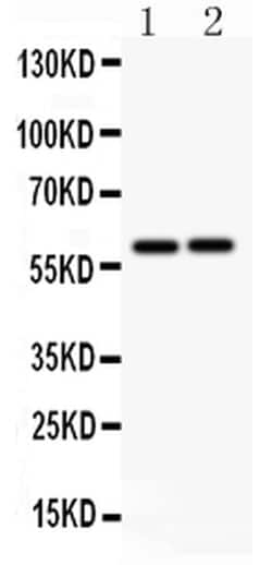 Invitrogen LTBR Polyclonal Antibody 100 &mu;g | Buy Online | Invitrogen&trade; | Fisher Scientific