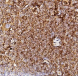 Invitrogen Ly-6A/E (Sca-1) Polyclonal Antibody 100 μg; Unconjugated:Antibodies,
