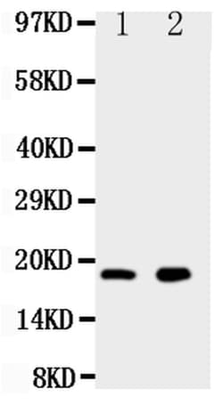 Invitrogen Ly6al Polyclonal Antibody 100 &mu;g | Buy Online | Invitrogen&trade; | Fisher Scientific