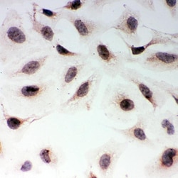 Invitrogen MAD1 Polyclonal Antibody 100 &mu;g; Unconjugated:Antibodies,
