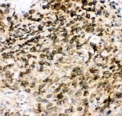 Invitrogen MAD1 Polyclonal Antibody 100 &mu;g; Unconjugated:Antibodies,