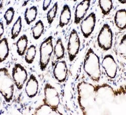 Invitrogen MAD1 Polyclonal Antibody 100 &mu;g; Unconjugated:Antibodies,