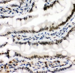 Invitrogen MAD1 Polyclonal Antibody 100 &mu;g; Unconjugated:Antibodies,