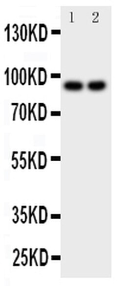 Invitrogen MALT1 Polyclonal Antibody 100 &mu;g; Unconjugated:Antibodies,