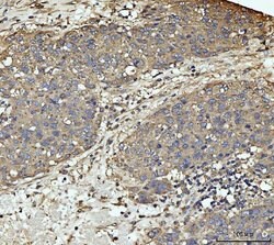 Invitrogen MEK3 Polyclonal Antibody 100 &mu;g; Unconjugated:Antibodies,