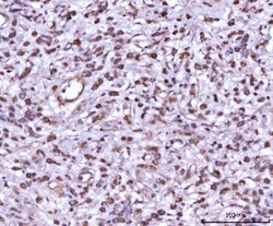 Invitrogen MKK7 Polyclonal Antibody 100 &mu;g; Unconjugated:Antibodies,