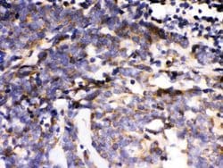 Invitrogen ERK3 Polyclonal Antibody 100 &mu;g; Unconjugated:Antibodies,