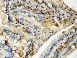 Invitrogen JNK1/JNK2 Polyclonal Antibody 100 &mu;g | Buy Online | Invitrogen&trade; | Fisher Scientific