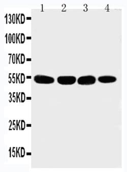 Invitrogen MATN3 Polyclonal Antibody 100 &mu;g; Unconjugated:Antibodies,