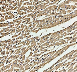 Invitrogen Myoglobin Polyclonal Antibody 100 &mu;g; Unconjugated:Antibodies,