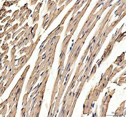 Invitrogen Myoglobin Polyclonal Antibody 100 &mu;g; Unconjugated:Antibodies,