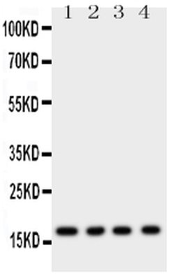 Invitrogen Myoglobin Polyclonal Antibody 100 &mu;g; Unconjugated:Antibodies,