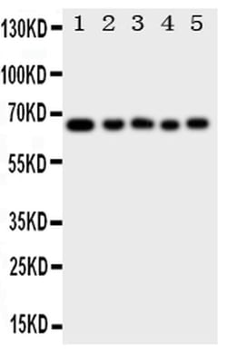 Invitrogen MBD4 Polyclonal Antibody 100 &mu;g | Buy Online | Invitrogen&trade; | Fisher Scientific