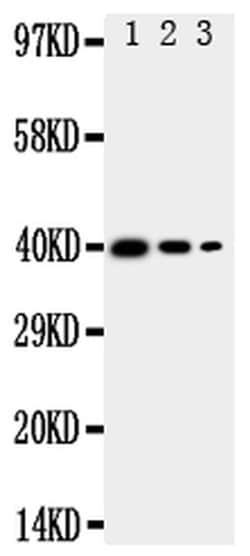 Invitrogen MBD4 Polyclonal Antibody 100 &mu;g | Buy Online | Invitrogen&trade; | Fisher Scientific