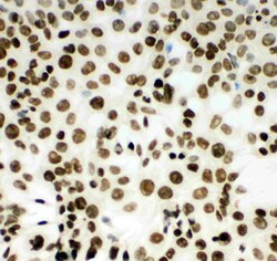 Invitrogen MCM2 Polyclonal Antibody 100 &mu;g; Unconjugated:Antibodies,
