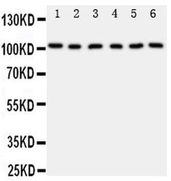 Invitrogen MCM2 Polyclonal Antibody 100 &mu;g; Unconjugated:Antibodies,