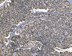 Invitrogen MCM7 Polyclonal Antibody 100 &mu;g; Unconjugated:Anticorps,