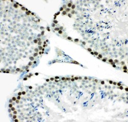 Invitrogen MCM7 Polyclonal Antibody 100 &mu;g; Unconjugated:Antibodies,