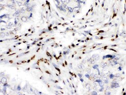 Invitrogen MDMX Polyclonal Antibody 100 &mu;g | Buy Online | Invitrogen&trade; | Fisher Scientific