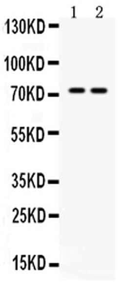 Invitrogen MDMX Polyclonal Antibody 100 &mu;g | Buy Online | Invitrogen&trade; | Fisher Scientific